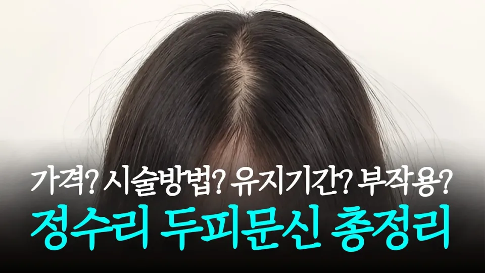 정수리 두피문신 가격 유지기간 부작용 완벽 정리